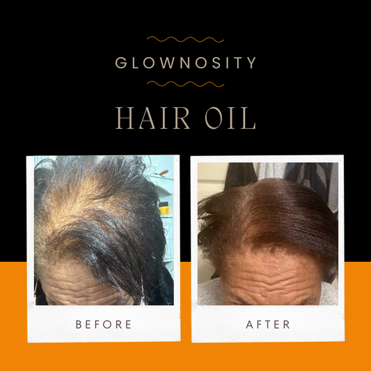 🧡 BEFORE + AFTER STORY 🧡
