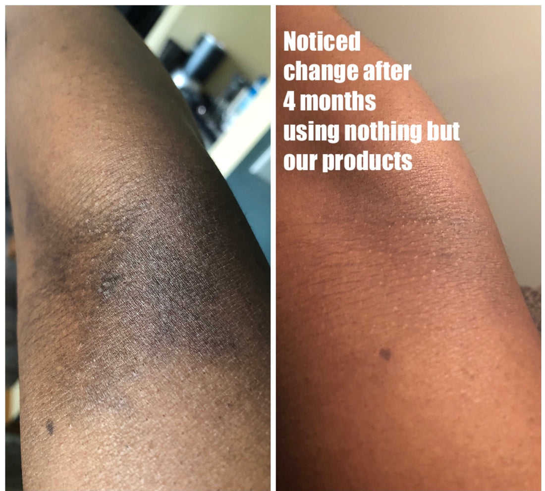 Dark spots? Itching?