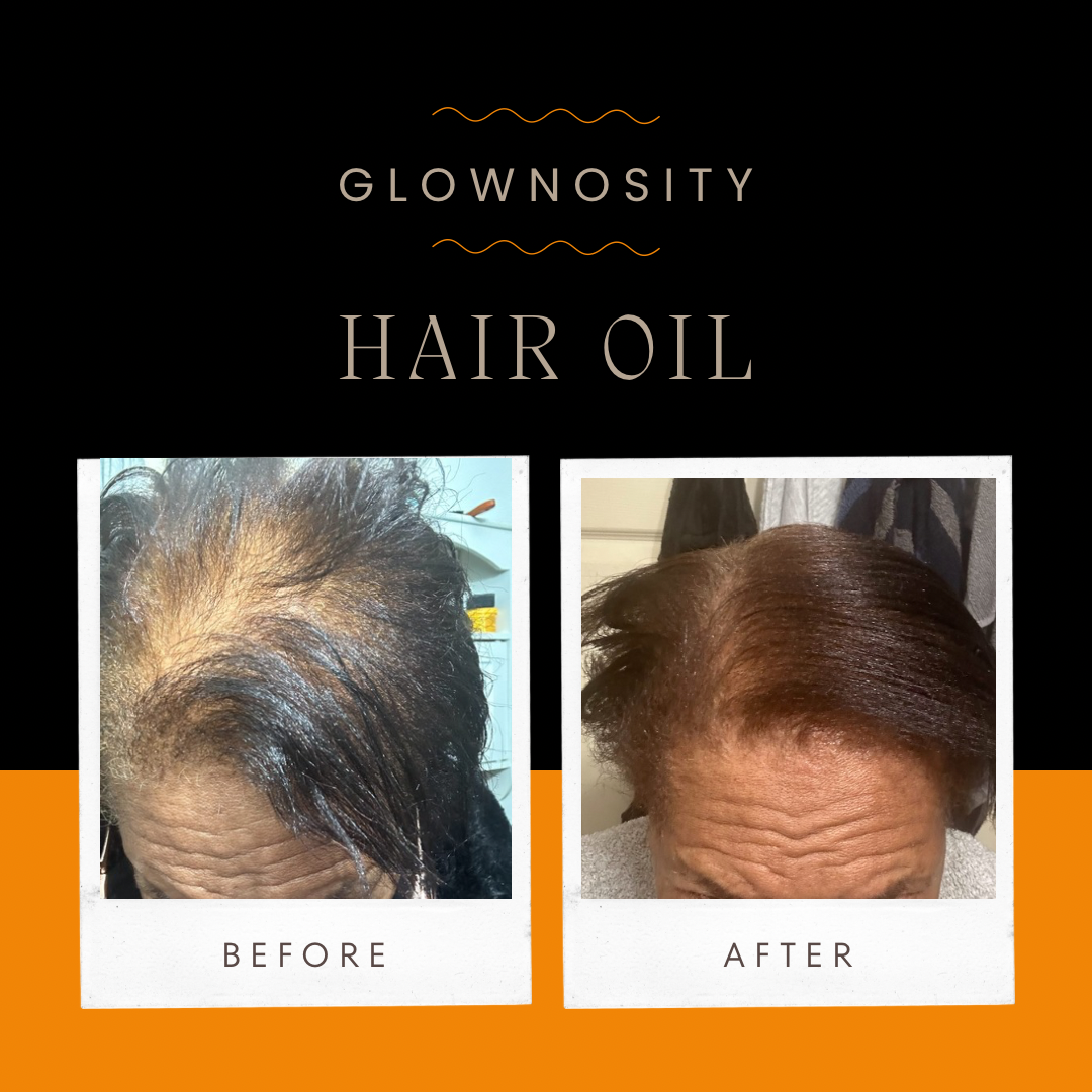 🧡 BEFORE + AFTER STORY 🧡